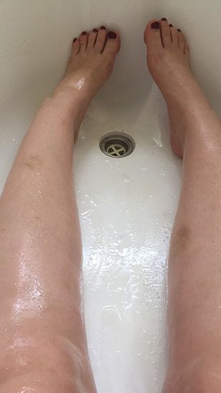 Woman's legs in coconut oil bath gone wrong